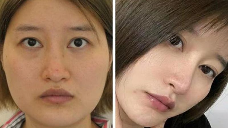小标题：恢复期化妆的必要性