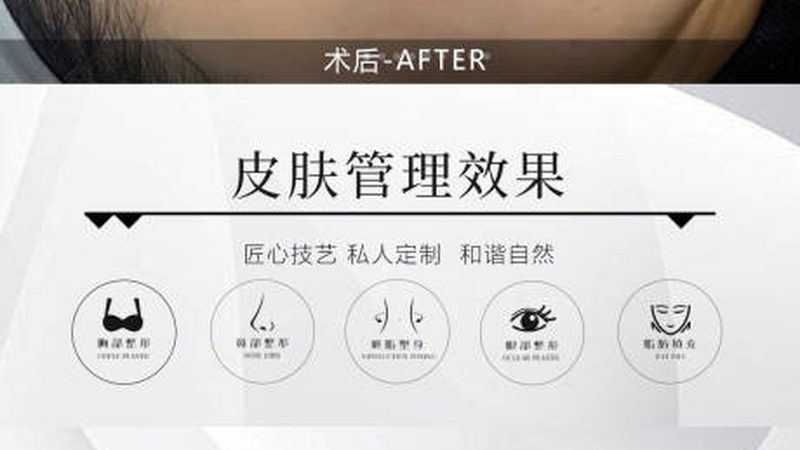 美容院玻尿酸代理加盟