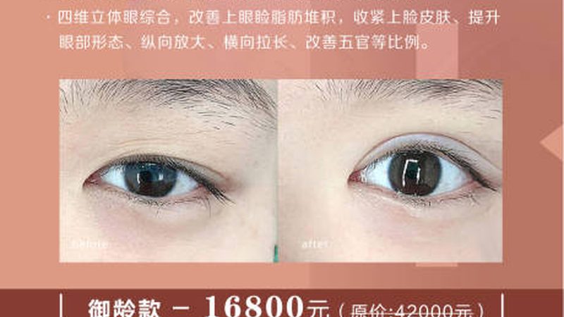 注射美容，价格几何？揭秘注射美容费用构成**