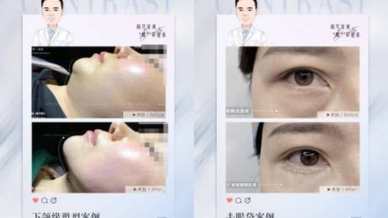 孕妇能用玻尿酸面膜吗？揭秘成分与安全性