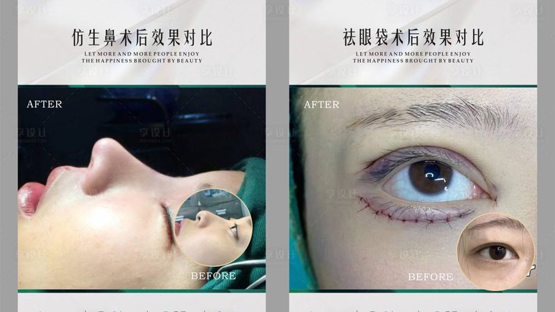 超声炮，揭秘其背后的技术秘密与选型要点**
