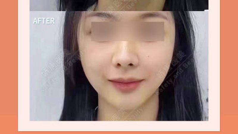 轻医美产品批发报价清单