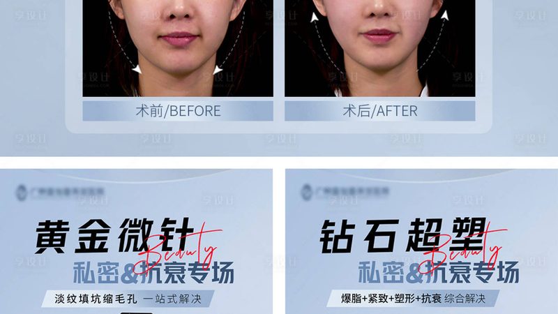 无锡隐形牙齿矫正：揭秘舒适与效果的完美融合