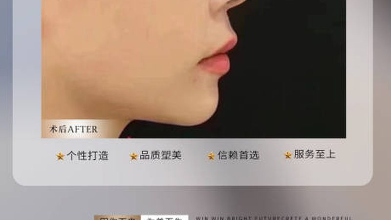 国产玻尿酸注射美容：揭秘其原理与优势