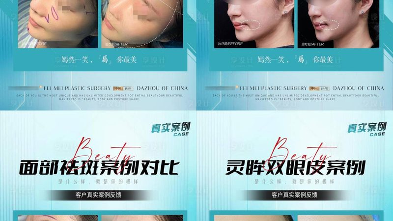 玻尿酸国产和进口安全性对比