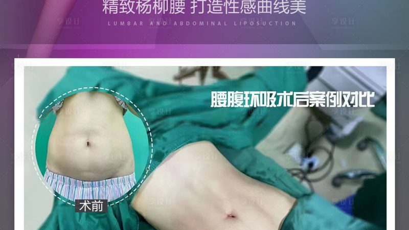 成都高端皮肤管理，收费标准背后的秘密