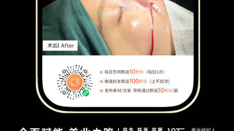 美容院光子嫩肤，揭秘专业流程步骤