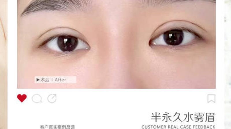 揭秘肉毒素代理加盟，揭秘成功案例背后的逻辑