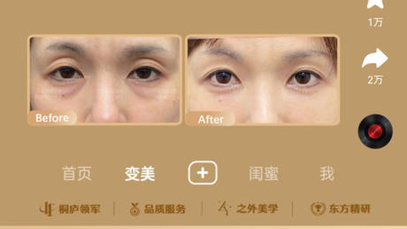 医美咨询师话术模拟：新手入门必知要点