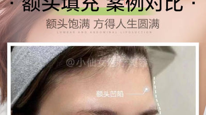 小型激光美容店加盟，揭秘加盟费用的那些事儿